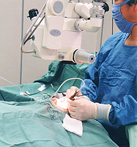 涙道内視鏡手術